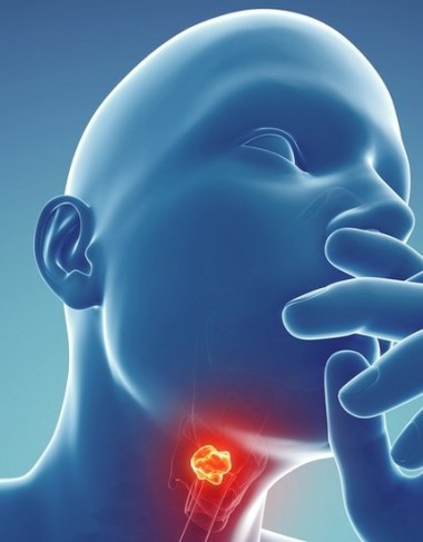 Throat cancer - Causes