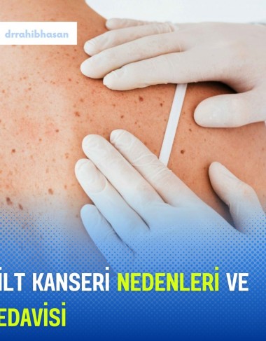 What is Skin Cancer?